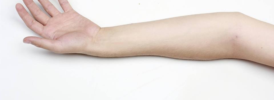 my arm